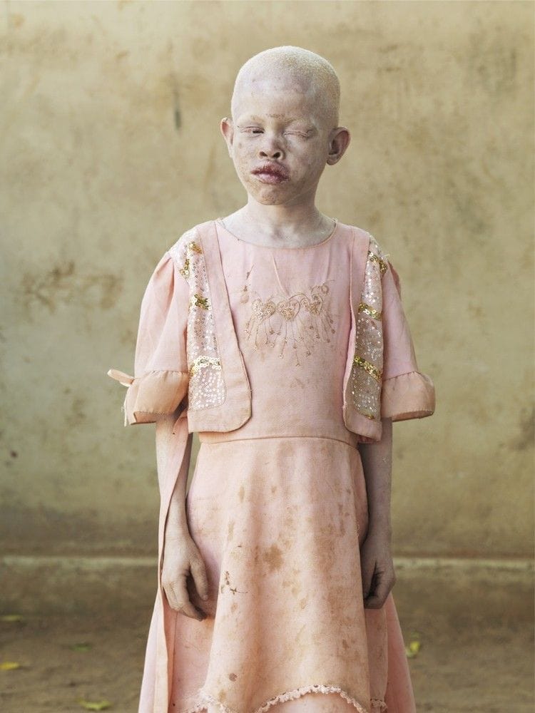 Les enfants albinos de Patrick Gries 1