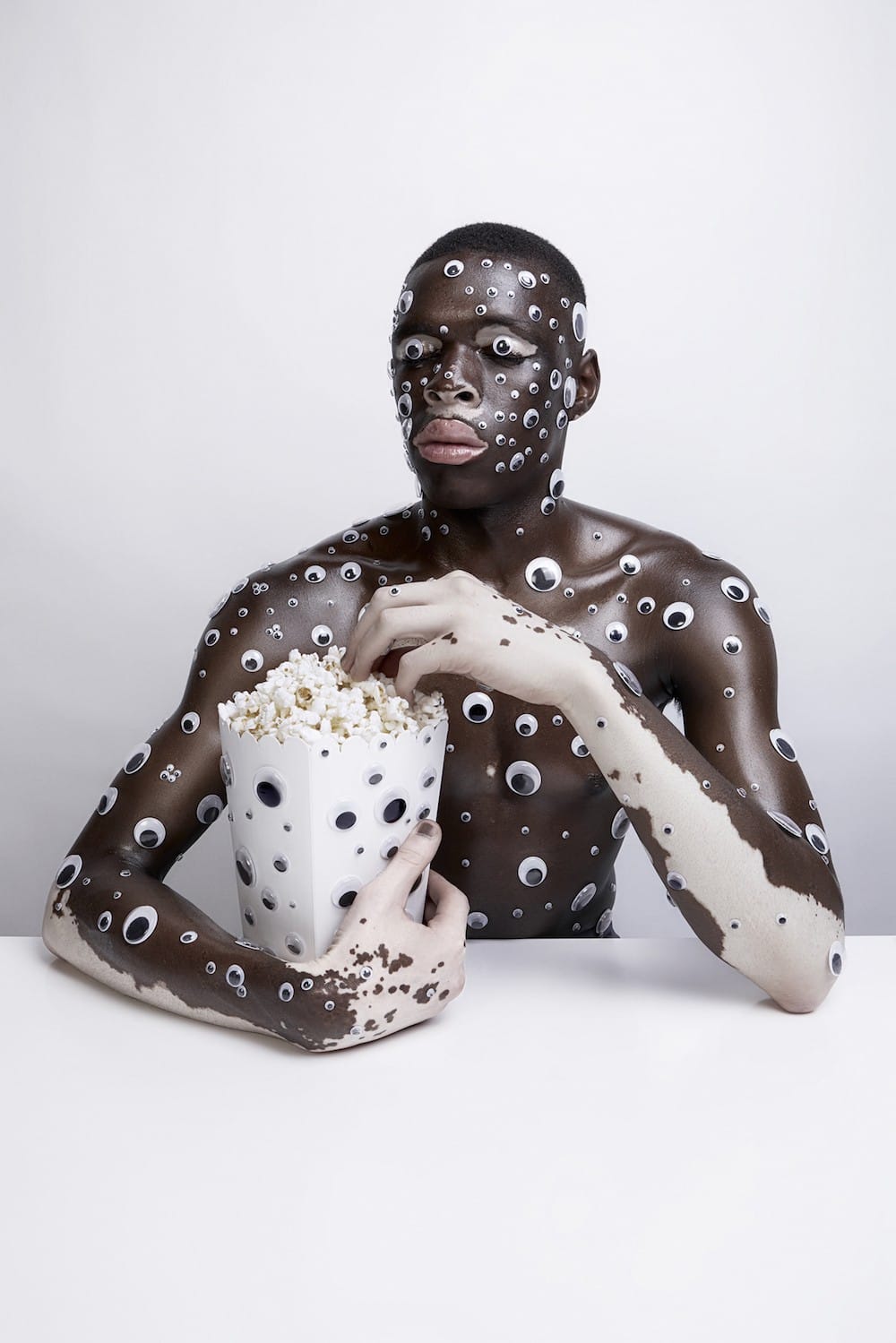  le vitiligo photographie