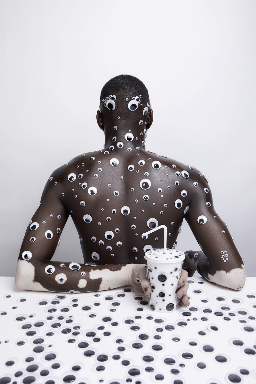 Coup de projecteur sur le vitiligo avec « A seat at the table » de Justin Dingwall 1