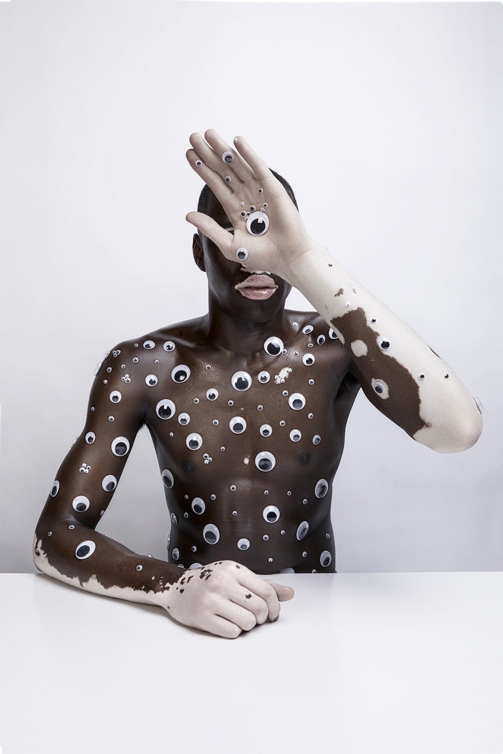le photographe Justin Dingwall capture le vitiligo