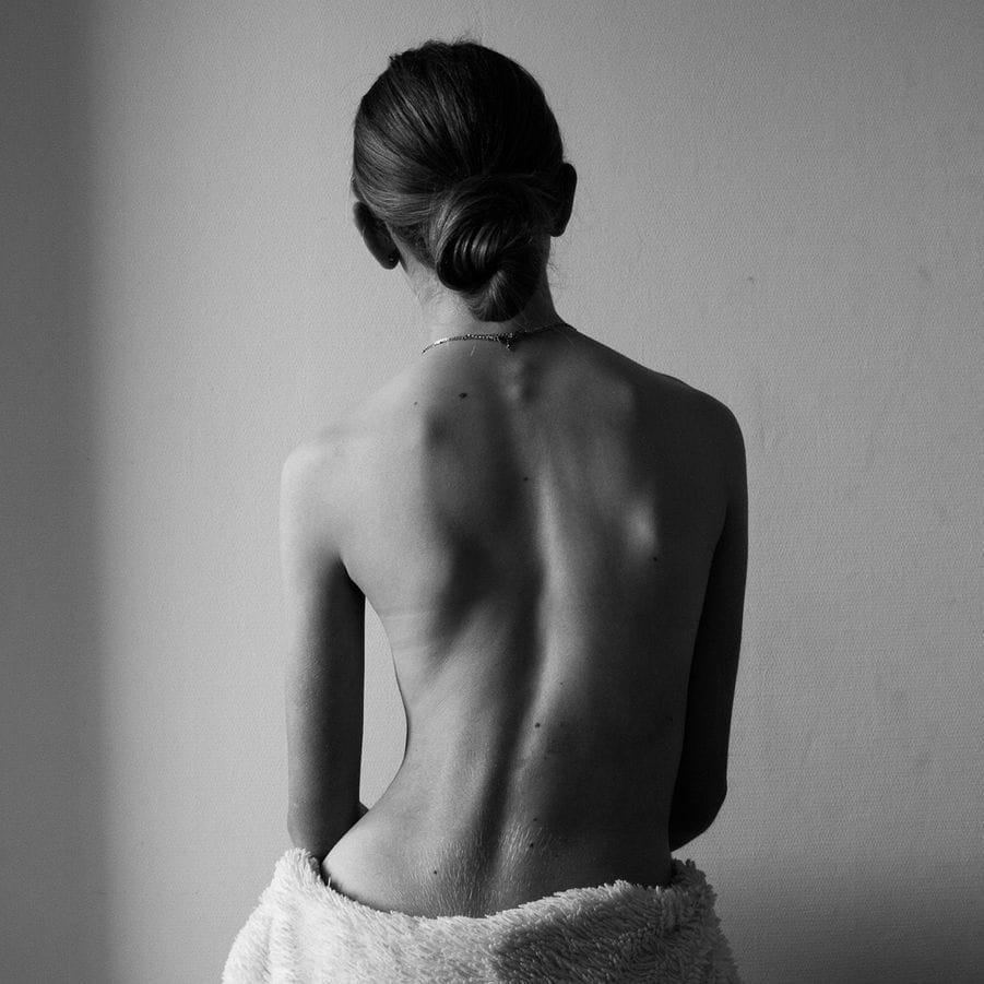 Photographie en noir et blanc, jeune fille de dos qui a une scoliose
