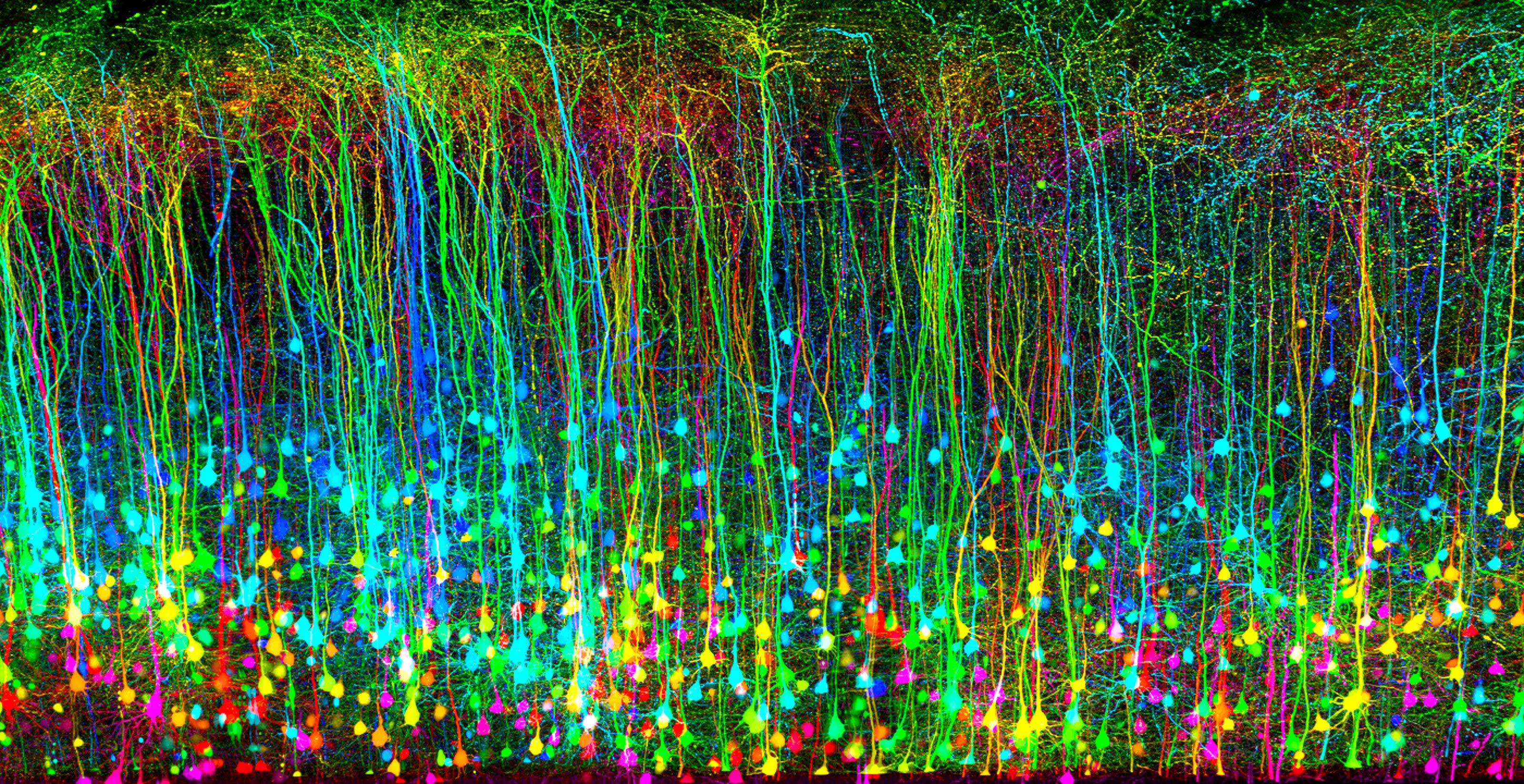 Traumatisme crânien d'une souris vu au microscope. Il forme des centaines de filaments "tombants" aux couleurs vives et fluorescentes.